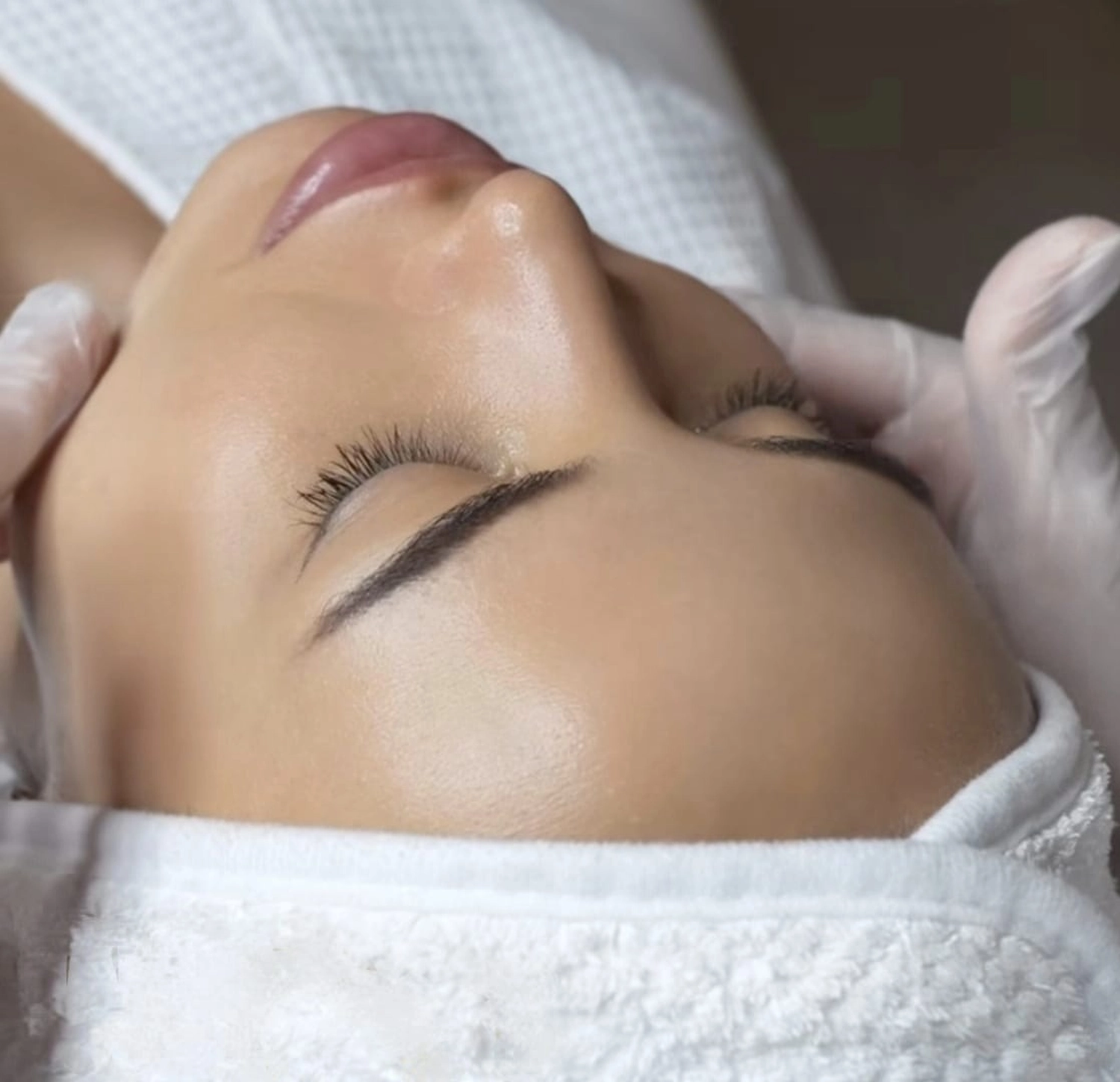 Milo's beauty oasis - Microneedling