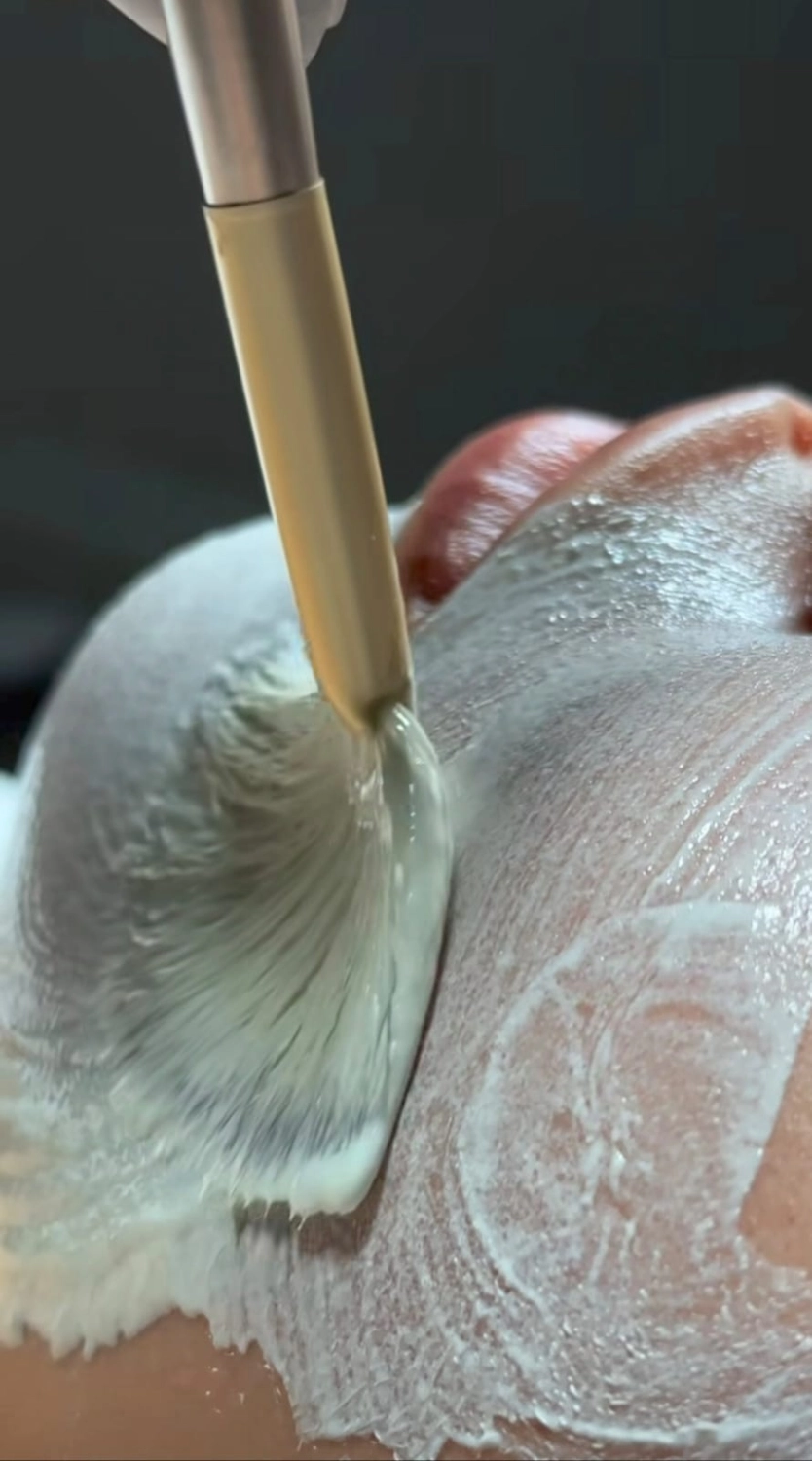 Milo's beauty oasis - Microneedling